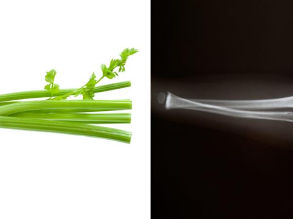 Ali podobnost res zdravi?